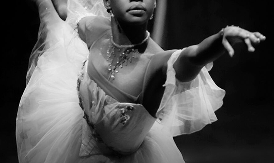 ‘DWTS’ Ballerina, Who Was Mocked for Spots on Her Skin, Dead at 29 – Tragic Details