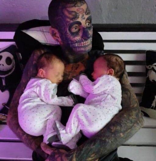 A 24-year-old father, who has several tattoos all over his body, makes the decision to get them erased for his child